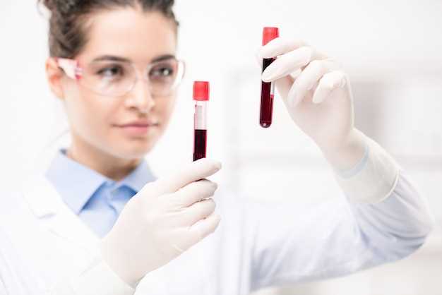 Важность анализа крови ат ТПО для оценки работы щитовидной железы
